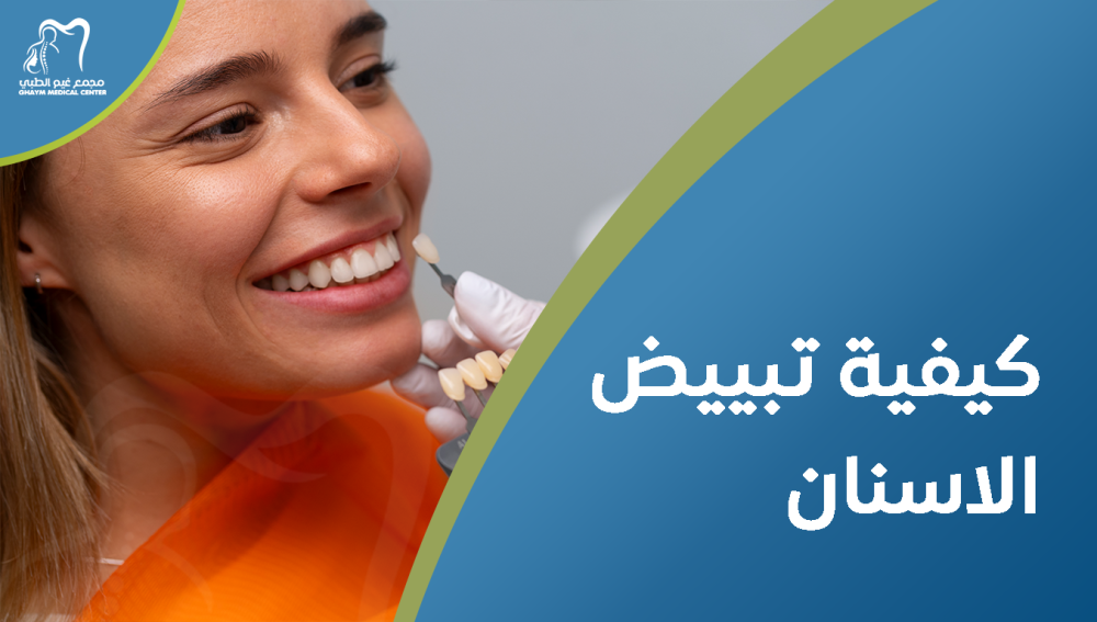 كيفية تبييض الاسنان