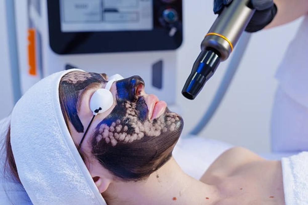 فوائد جلسة ليزر كربوني