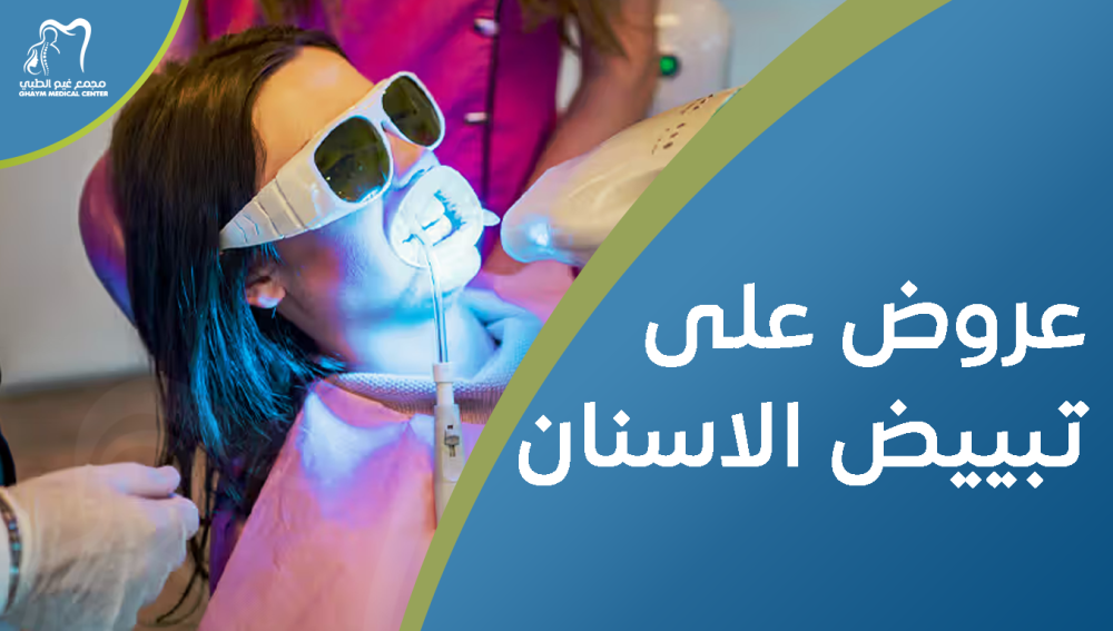 عروض على تبييض الاسنان