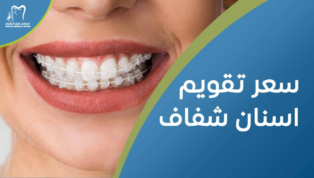 سعر تقويم اسنان شفاف