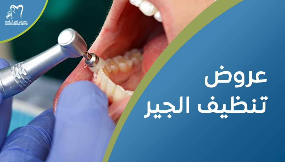 عروض تنظيف الجير