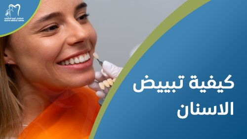 كيفية تبييض الاسنان | طرق فعالة للحصول على ابتسامة بيضاء