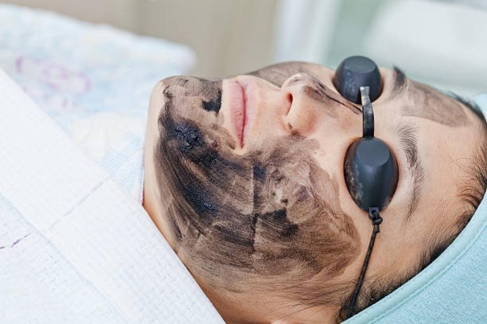 تقشير كربوني للوجه بالليزر