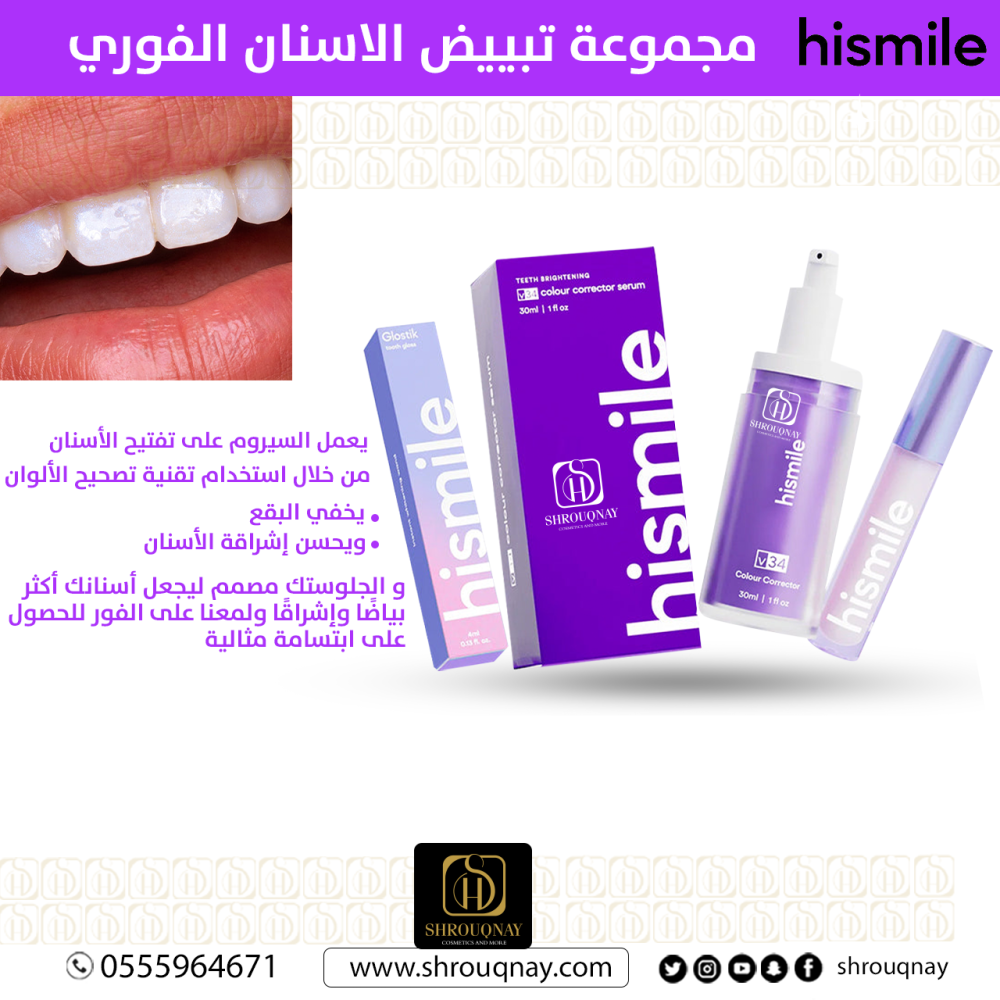 هاي سمايل مجموعة تبييض الاسنان الفوري