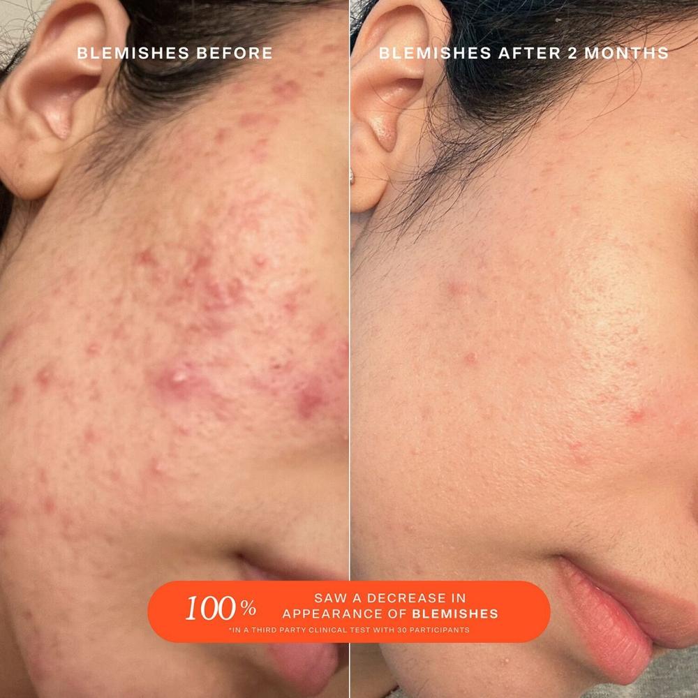 تاور 28 بخاخ اس او اس للحماية اليومية للوجه 30 مل