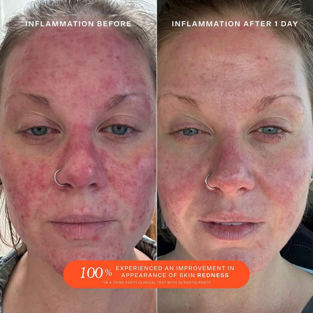 تاور 28 بخاخ اس او اس للحماية اليومية للوجه 30 مل