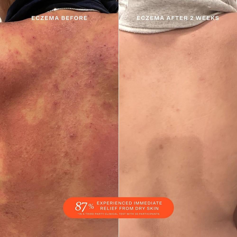 تاور 28 بخاخ اس او اس للحماية اليومية للوجه 30 مل