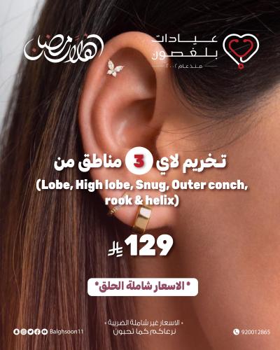 تخريم 3 مناطق من ( Lobe , High lobe ,Snug , Outer...