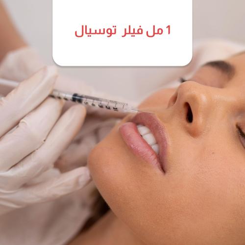 1 مل فيلر توسيال مع الأخصائيات