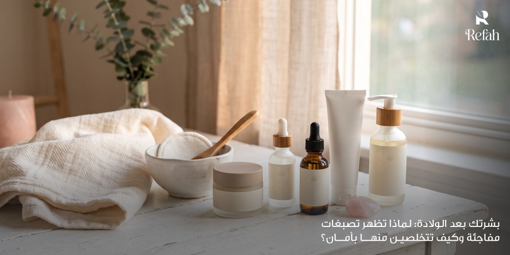بشرتك بعد الولادة: لماذا تظهر تصبغات مفاجئة وكيف تتخلصين منها بأمان؟