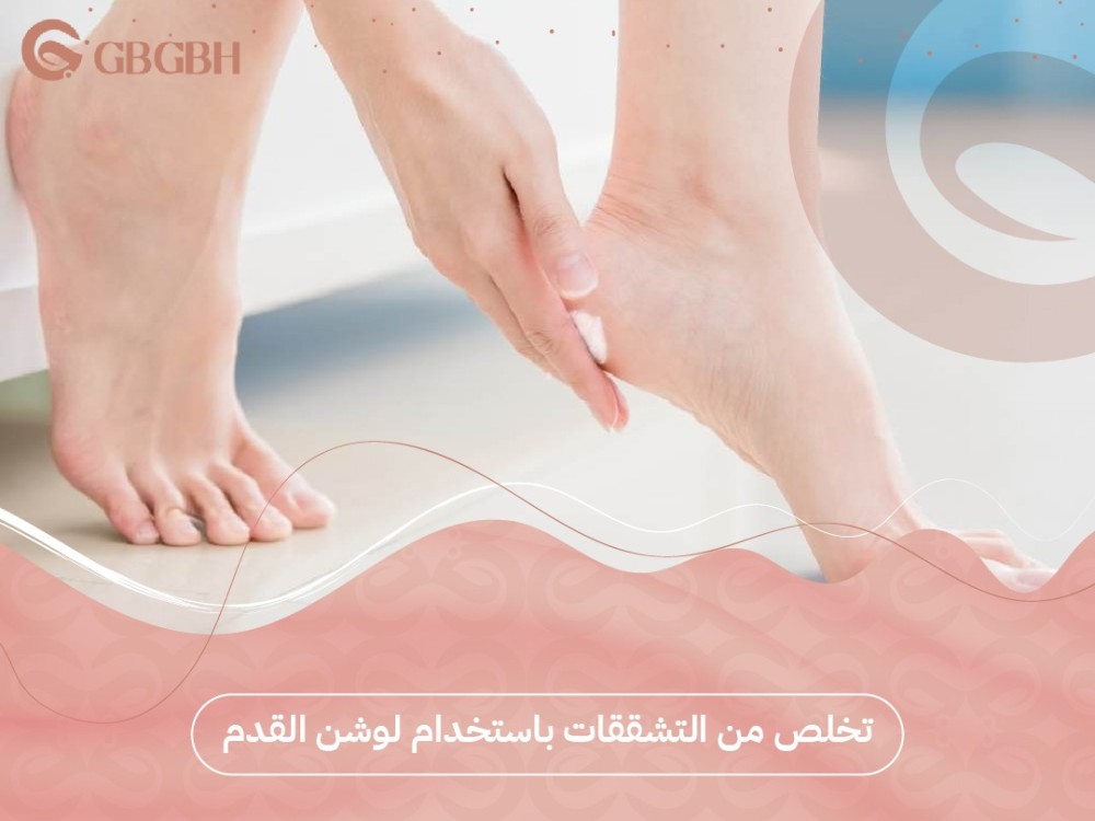 كيف اتخلص من التشققات في باستخدامات لوشن القدم؟