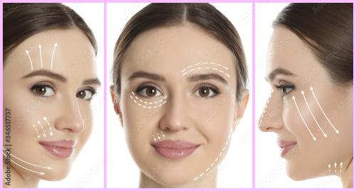 جلسة نضارة وتفتيح اكسوزوم+ ديرمابن+ ماسك