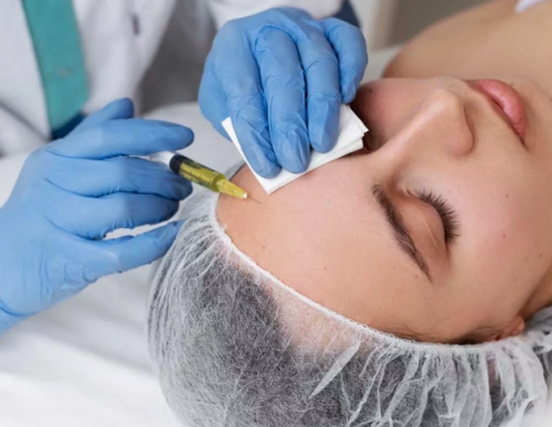 PRP (Platelet-Rich Plasma) Therapy Session with Exosomes, Hyaluronic Acid, Vitamin B, Vitamin C, and Glutathione - Dr. Noha Baathman