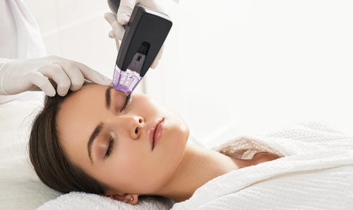 جلسة مورفيس للوجه مع البلازما