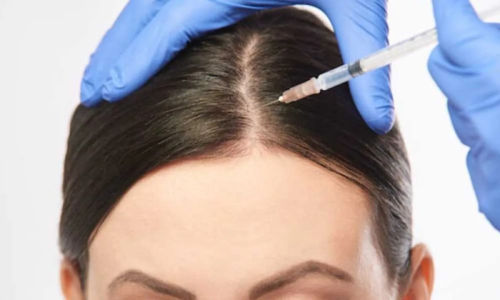 Free plasma hair treatment + dermapen