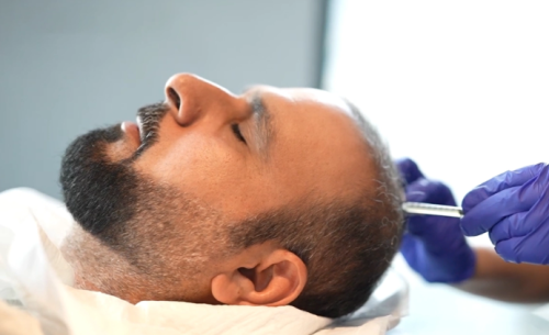 3 PRP (Plasma) sessions + Hyaluronic Acid hydration - Dr. Noha Baathman