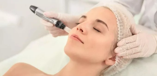 Free plasma facial session + dermapen