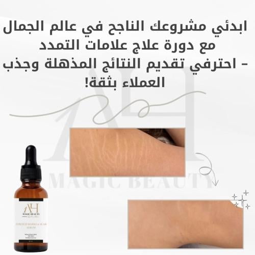 دورة علاج علامات التمدد