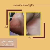 عرض كريم معالج تشققات القدمين 3عبوات