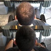 2 خافي عيوب الشعر 50 مل + شامبو برو فيتامين B5 الم...