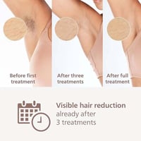 فيليبس BRI932/02 جهاز ازالة الشعر بالنبض الضوئي لو...