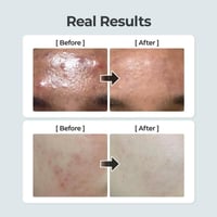 نومبوزين 1 تونر الاعشاب المهدئ النقي - 300 مل