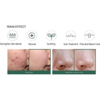 سوم باي مي كريم أحماض التقشير المعجزة - 60 جم