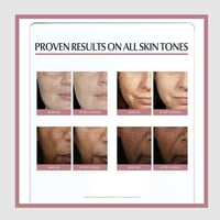 يوسرين إيفن بيغمنت بيرفكتور سيروم مزدوج مضاد للتصب...