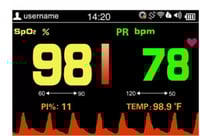 بلس أوكسيميتر للأطفال SP-20 بسلك ومِشَحّن مناسب لل...