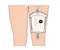 كيس جمع بول للساق Ritecare طراز ASP013 سعة 500 مل...