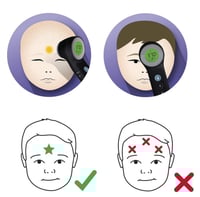 براون ترموسكان جهاز قياس الحرارة عن بعد BRAUN THER...