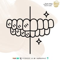 تبييض الأسنان بجهاز الزوم الامريكي + تنظيف الأسنان