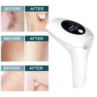 جهاز ليزر ازالة الشعر بالضوء النبضي المكثف AM001 م...