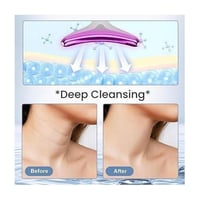 جهاز تقليل التجاعيد بالضوء النبضي المكثف IPL موديل...