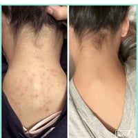 بانوكسيل - غسول رغوي لحب الشباب بنزويل بيروكسيد 10...