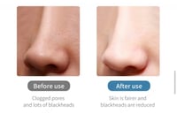 جهاز الهيدرافيشل المنزلي لتنظيف البشرة ولإزالة الر...