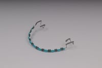 تقويم اسنان بدون غرا (فك واحد)