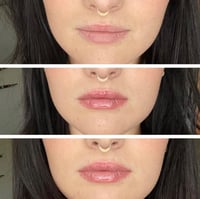 قلوس تكبير الشفايف