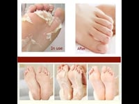 الجوارب السحرية لتقشير القدمين الكورية