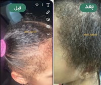 زيت الأطفال افروهير