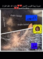 كورس التنبيت العلاجي