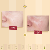 غسول الوجه الطبيعي لتنظيف وترطيب البشرة