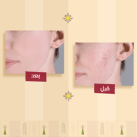 روتين العناية الصباحية