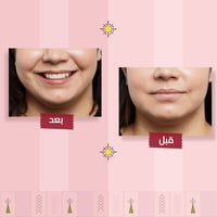 مرطب الشفاة| 6ml