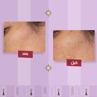 مقشر القهوة الطبيعي للبشرة