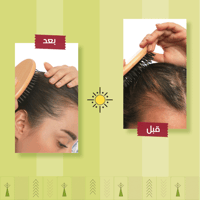 مجموعة علاج تساقط الشعر للأطفال و الحوامل