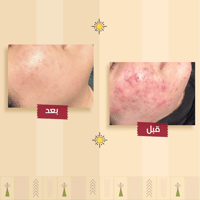 مجموعة العناية الليلية