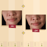 سيروم الهيالورونيك الطبيعي لعلاج التجاعيد وشد البش...