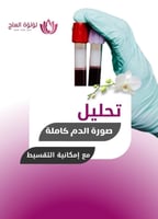 ربط عنق الرحم - مستشفى العبير (الجافل سابقا)