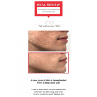 مجموعة الحلزون الاسود لتجديد البشرة من سوم باي مي